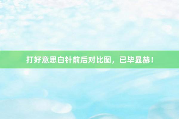 打好意思白针前后对比图，已毕显赫！