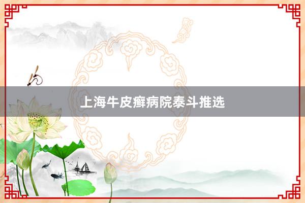 上海牛皮癣病院泰斗推选